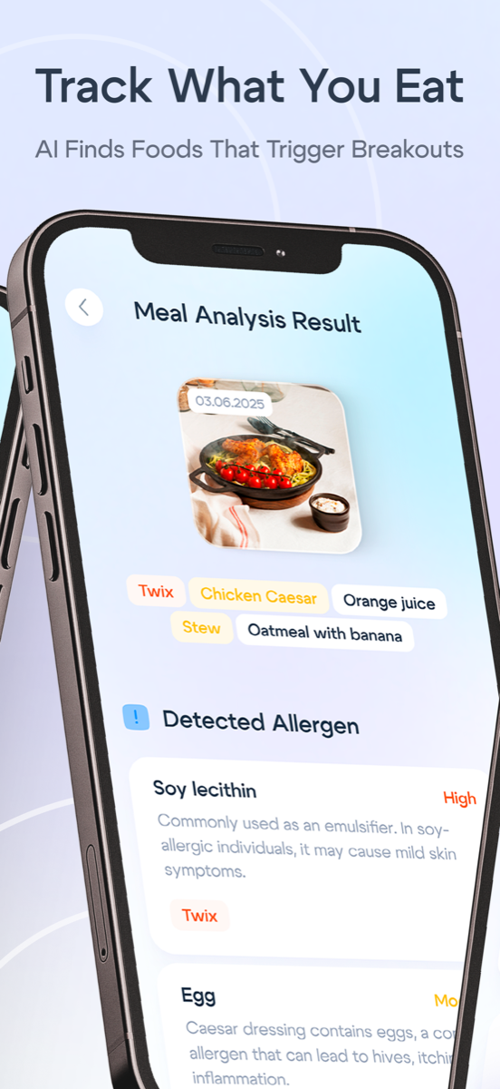 Lumé screen — Meal analysis and allergen detection