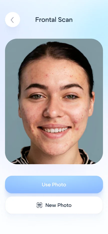 Onboarding screen 31: photo